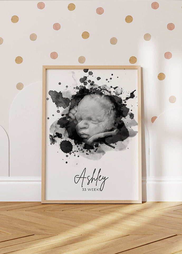 Tablou Personalizat cu Ecografie Bebe – Ramă 40x50 cm cu Nume
