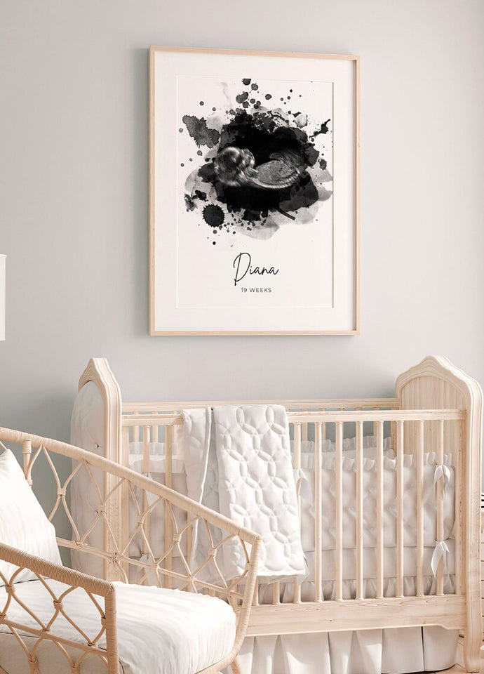 Tablou Personalizat cu Ecografie Bebe – Ramă 40x50 cm cu Nume